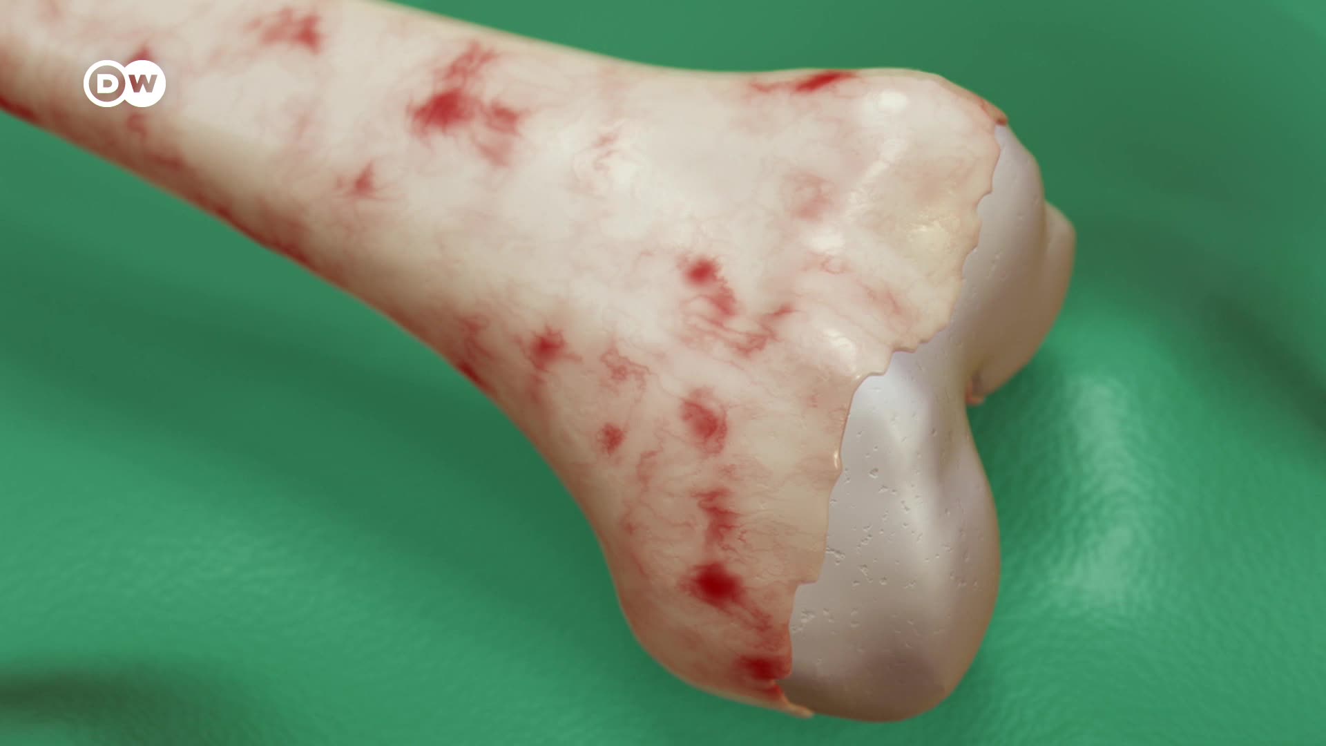 Thumbnail image for In Good Shape