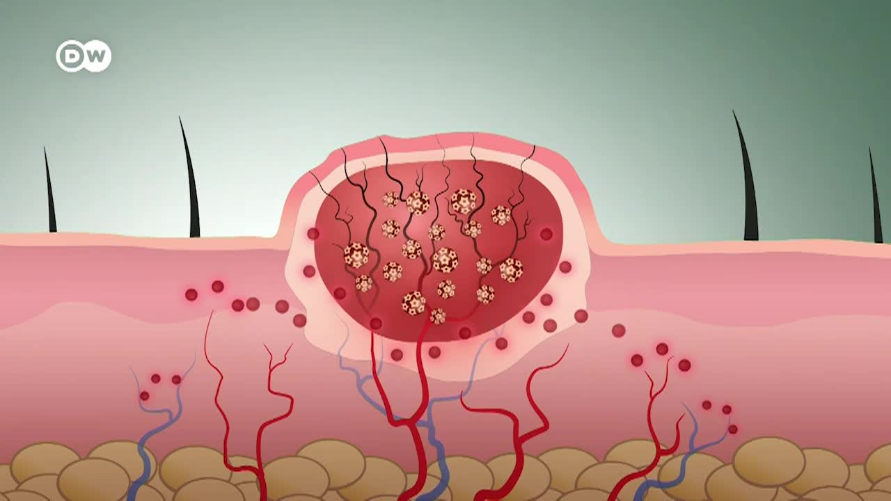 Thumbnail image for In Good Shape